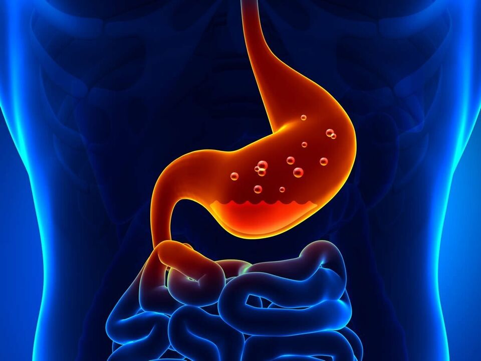 Gastritida je zánětlivé onemocnění žaludku, které vyžaduje dietu